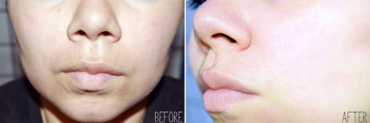 Skin Detoxifying Clay Mask,Valentia Clear Lift Revitalizing Serum, Valentia, beauty, products, review, beauty review, bblogger, bellashoot, skincare, cruelty free, demo, face masks,