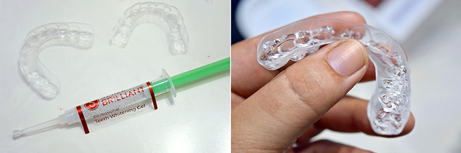 Smile brilliant, whitening, teeth whitening, teeths, dentist, at home whitening, beauty, lifestyle, before and after, dental, brighter white, smile, teeth whitening kit, review, beauty review, makeup, bblogger