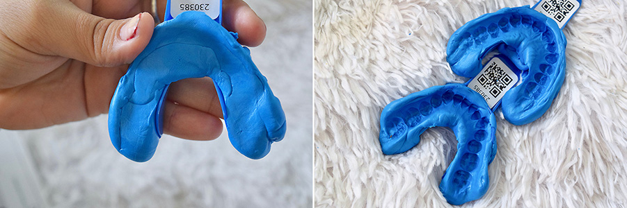 Smile brilliant, whitening, teeth whitening, teeths, dentist, at home whitening, beauty, lifestyle, before and after, dental, brighter white, smile, teeth whitening kit, review, beauty review, makeup, bblogger