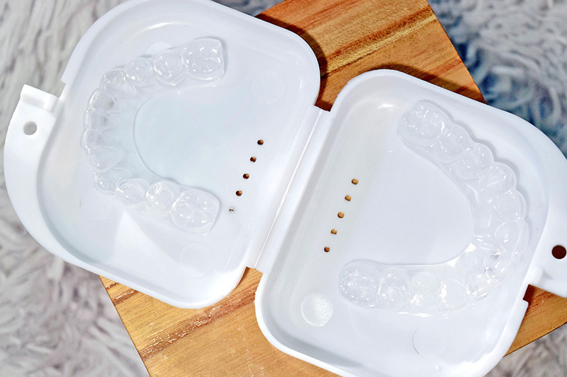 Smile brilliant, whitening, teeth whitening, teeths, dentist, at home whitening, beauty, lifestyle, before and after, dental, brighter white, smile, teeth whitening kit, review, beauty review, makeup, bblogger