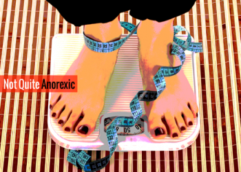 Anorexic weight